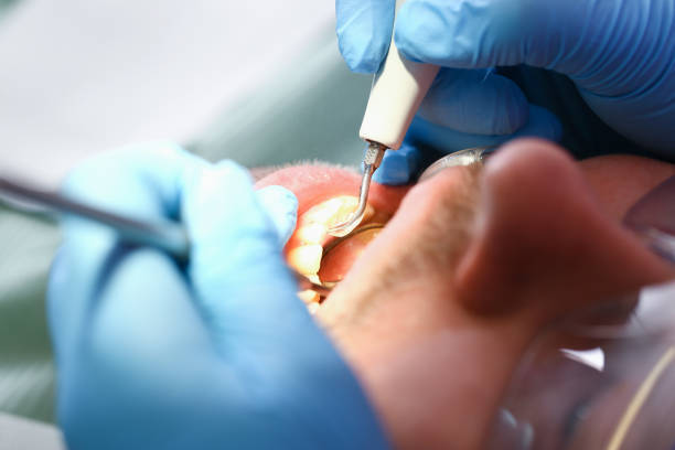 Best Urgent Tooth Repair  in Mendota, CA